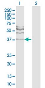 RAD51C Polyclonal Antibody, MaxPab™