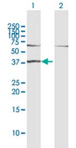 RAD51L1 Polyclonal Antibody, MaxPab™