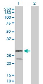 RAGE Polyclonal Antibody, MaxPab™