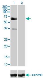RAF1 Monoclonal Antibody (1H4)