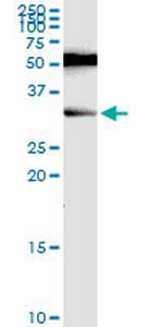 RAG2 Monoclonal Antibody (2G8)