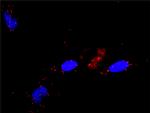 RALGDS Antibody in Proximity Ligation Assay (PLA) (PLA)