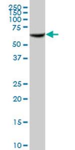 RAP1GDS1 Antibody in Western Blot (WB)
