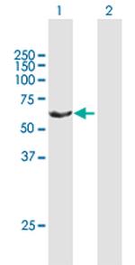 RAP1GDS1 Antibody in Western Blot (WB)