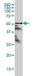 RARA Monoclonal Antibody (1C10)