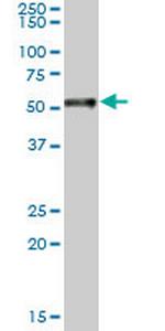 RARA Monoclonal Antibody (2C3)