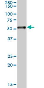 RARA Antibody in Western Blot (WB)