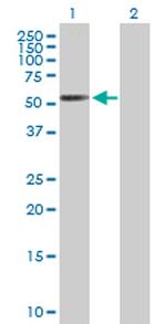 RARB Antibody in Western Blot (WB)