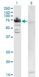 RARS Monoclonal Antibody (1A2)