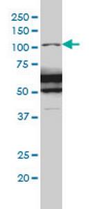 RASA1 Monoclonal Antibody (2C12)