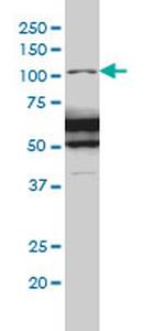 RASA1 Antibody in Western Blot (WB)