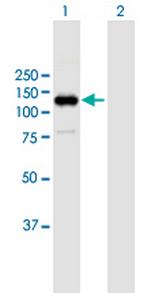 RB1 Antibody in Western Blot (WB)