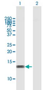 RBBP6 Polyclonal Antibody, MaxPab™