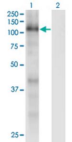 RBL1 Monoclonal Antibody (1A5)