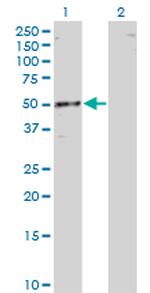 RBMS1 Monoclonal Antibody (3F2-2G9)