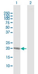 RBP4 Antibody in Western Blot (WB)