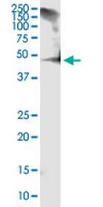 RCN1 Monoclonal Antibody (1F8-E4)