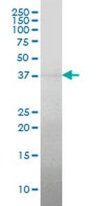 RCN2 Antibody in Western Blot (WB)