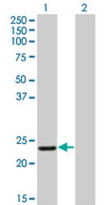 RCV1 Monoclonal Antibody (1D3)