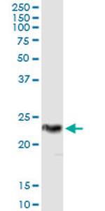 RCV1 Antibody in Immunoprecipitation (IP)