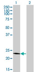 RCV1 Monoclonal Antibody (4E2)
