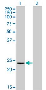 RCV1 Monoclonal Antibody (2B3)