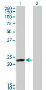 RCV1 Monoclonal Antibody (1B7)