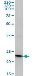 RCV1 Monoclonal Antibody (3F6)