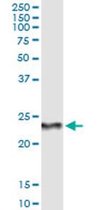 RCV1 Antibody in Immunoprecipitation (IP)
