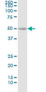 REN Monoclonal Antibody (2H2)
