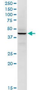 RFC5 Monoclonal Antibody (1B1)