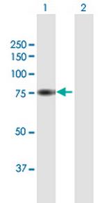 RFX5 Antibody in Western Blot (WB)