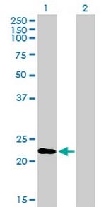 RGS1 Antibody in Western Blot (WB)