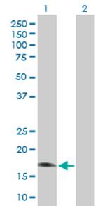 RGS3 Antibody in Western Blot (WB)