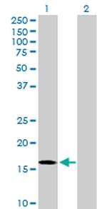 RGS3 Antibody in Western Blot (WB)
