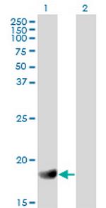 RGS3 Antibody in Western Blot (WB)