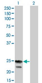 RGS4 Antibody in Western Blot (WB)