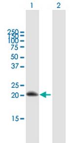 RGS10 Antibody in Western Blot (WB)