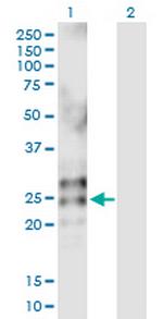 RNASE2 Polyclonal Antibody, MaxPab™