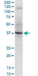 RNF2 Monoclonal Antibody (2B6)