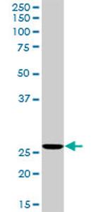 RNH1 Antibody in Western Blot (WB)