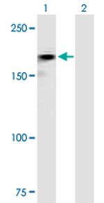 ROBO2 Polyclonal Antibody, MaxPab™