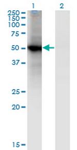 RORB Antibody in Western Blot (WB)