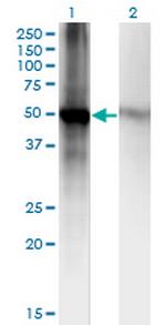 RORB Monoclonal Antibody (1E5)