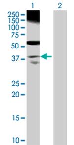 RP2 Polyclonal Antibody, MaxPab™