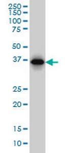 RP2 Monoclonal Antibody (5C10)