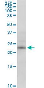 RPE Polyclonal Antibody, MaxPab™