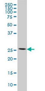 RPL13 Monoclonal Antibody (3F6)