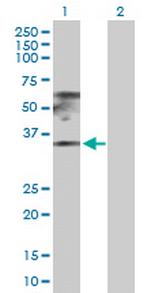 RPL17 Polyclonal Antibody, MaxPab™