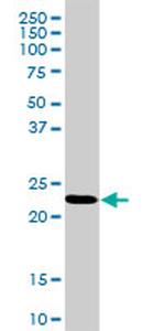 RPL18 Antibody in Western Blot (WB)